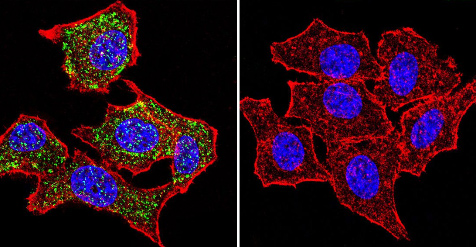 Immunocytochemistry/ Immunofluorescence - Anti-Glucocorticoid Receptor alpha antibody (AB3580), expandable thumbnail