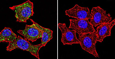 Immunocytochemistry/ Immunofluorescence - Anti-Glucocorticoid Receptor alpha antibody (AB3580)