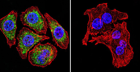 Immunocytochemistry/ Immunofluorescence - Anti-Glucocorticoid Receptor alpha antibody (AB3580), expandable thumbnail