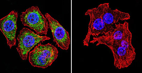 Immunocytochemistry/ Immunofluorescence - Anti-Glucocorticoid Receptor alpha antibody (AB3580)