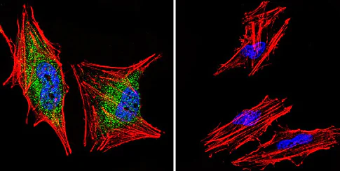 Immunocytochemistry/ Immunofluorescence - Anti-Glucocorticoid Receptor alpha antibody (AB3580)