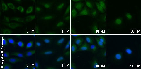 Immunocytochemistry/ Immunofluorescence - Anti-Glucocorticoid Receptor alpha antibody (ab3580), expandable thumbnail