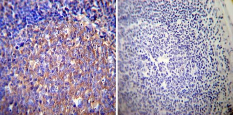 Immunohistochemistry (Formalin/PFA-fixed paraffin-embedded sections) - Anti-Glucocorticoid Receptor alpha antibody (AB3580), expandable thumbnail