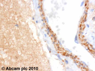 Immunohistochemistry (Formalin/PFA-fixed paraffin-embedded sections) - Anti-Glucocorticoid Receptor alpha antibody (ab3580), expandable thumbnail