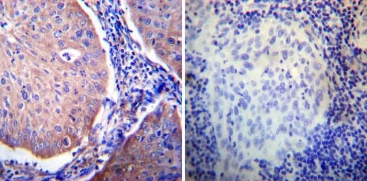 Immunohistochemistry (Formalin/PFA-fixed paraffin-embedded sections) - Anti-Glucocorticoid Receptor alpha antibody (AB3580), expandable thumbnail