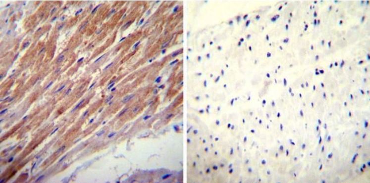 Immunohistochemistry (Formalin/PFA-fixed paraffin-embedded sections) - Anti-Glucocorticoid Receptor alpha antibody (ab3580), expandable thumbnail