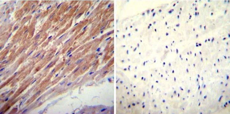 Immunohistochemistry (Formalin/PFA-fixed paraffin-embedded sections) - Anti-Glucocorticoid Receptor alpha antibody (AB3580)