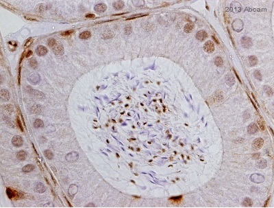 Immunohistochemistry (Formalin/PFA-fixed paraffin-embedded sections) - Anti-Glucocorticoid Receptor alpha antibody (ab3580), expandable thumbnail