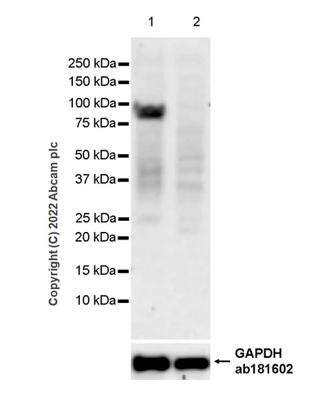 Western blot - Anti-Glucocorticoid Receptor antibody [2153CT307.32.80] (AB307605)