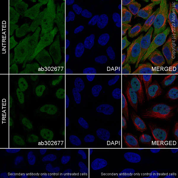 Immunocytochemistry/ Immunofluorescence - Anti-Glucocorticoid receptor antibody [41/Glucocorticoid Receptor] (AB302677)