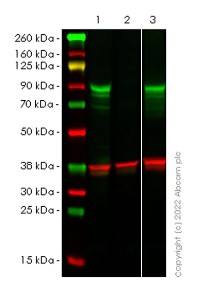 Western blot - Anti-Glucocorticoid receptor antibody [41/Glucocorticoid Receptor] (AB302677)