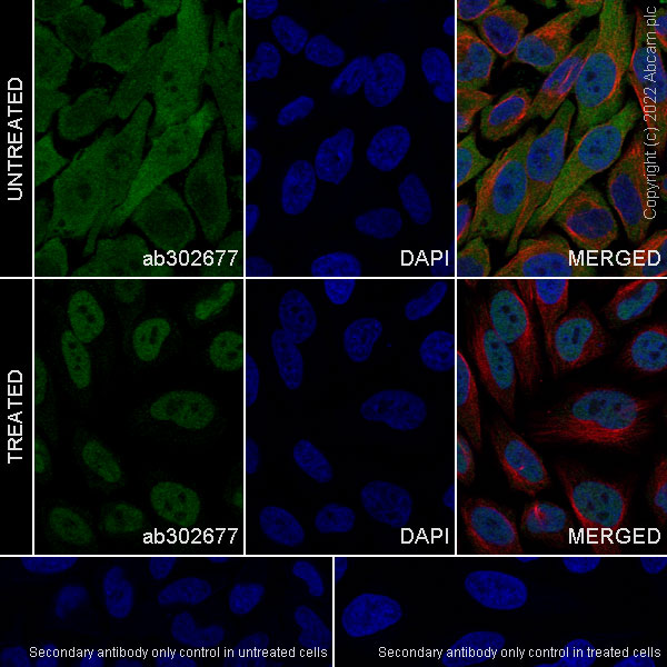 Immunocytochemistry/ Immunofluorescence - Anti-Glucocorticoid receptor antibody [41/Glucocorticoid Receptor] - BSA and Azide Free (AB302678), expandable thumbnail