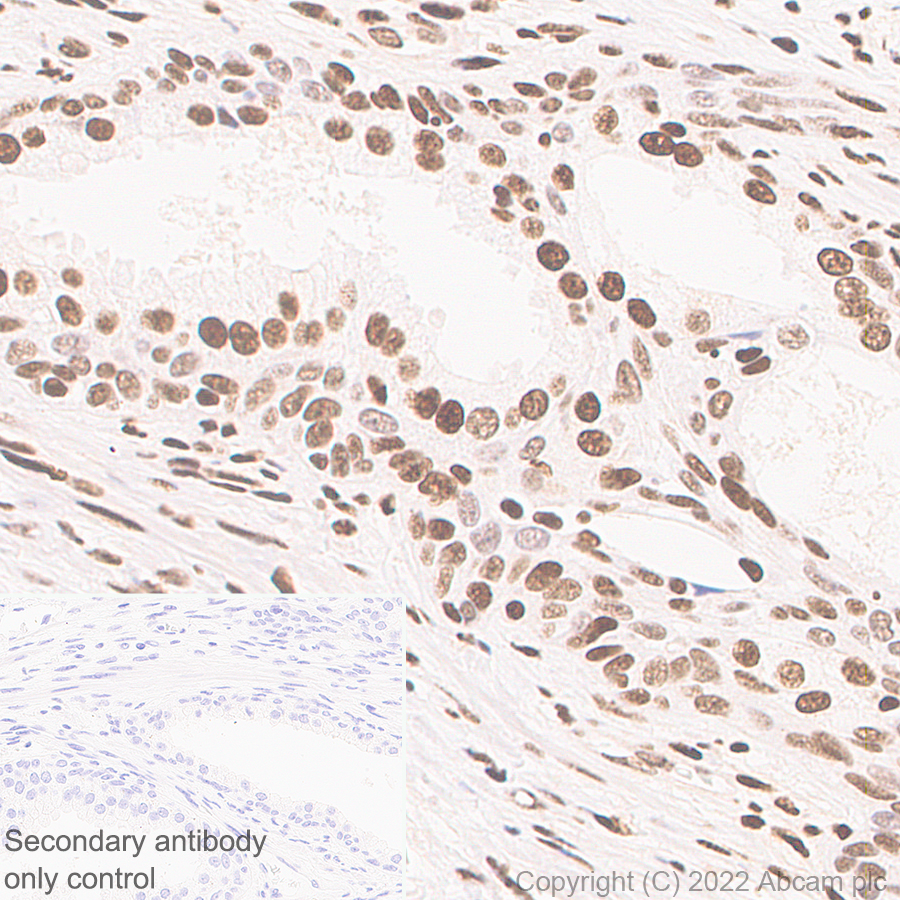Immunohistochemistry (Formalin/PFA-fixed paraffin-embedded sections) - Anti-Glucocorticoid receptor antibody [41/Glucocorticoid Receptor] - BSA and Azide Free (AB302678), expandable thumbnail