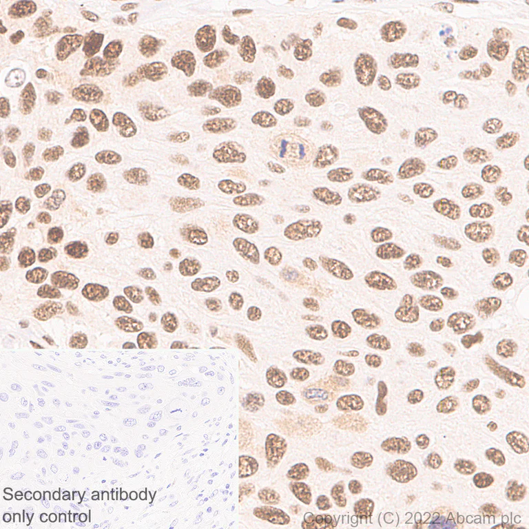 Immunohistochemistry (Formalin/PFA-fixed paraffin-embedded sections) - Anti-Glucocorticoid receptor antibody [41/Glucocorticoid Receptor] - BSA and Azide Free (AB302678)