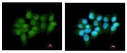 Immunocytochemistry/ Immunofluorescence - Anti-Glucocorticoid Receptor antibody (AB227524)