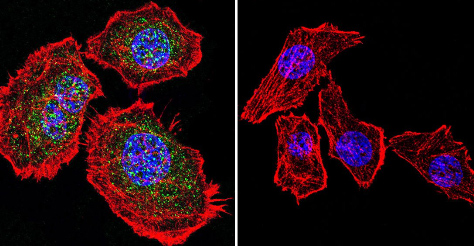 Immunocytochemistry/ Immunofluorescence - Anti-Glucocorticoid Receptor antibody (AB3578), expandable thumbnail