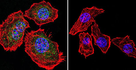 Immunocytochemistry/ Immunofluorescence - Anti-Glucocorticoid Receptor antibody (AB3578)