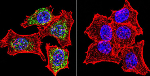 Immunocytochemistry/ Immunofluorescence - Anti-Glucocorticoid Receptor antibody (AB3578), expandable thumbnail