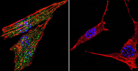 Immunocytochemistry/ Immunofluorescence - Anti-Glucocorticoid Receptor antibody (AB3578), expandable thumbnail