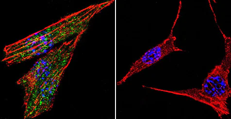 Immunocytochemistry/ Immunofluorescence - Anti-Glucocorticoid Receptor antibody (AB3578)