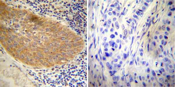 Immunohistochemistry (Formalin/PFA-fixed paraffin-embedded sections) - Anti-Glucocorticoid Receptor antibody (AB3578), expandable thumbnail