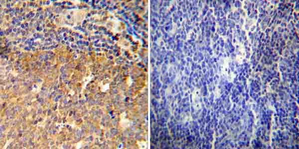 Immunohistochemistry (Formalin/PFA-fixed paraffin-embedded sections) - Anti-Glucocorticoid Receptor antibody (AB3578), expandable thumbnail