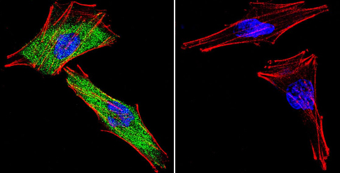 Immunocytochemistry/ Immunofluorescence - Anti-Glucocorticoid Receptor antibody (AB3579), expandable thumbnail