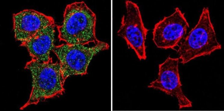 Immunocytochemistry/ Immunofluorescence - Anti-Glucocorticoid Receptor antibody (AB3579), expandable thumbnail