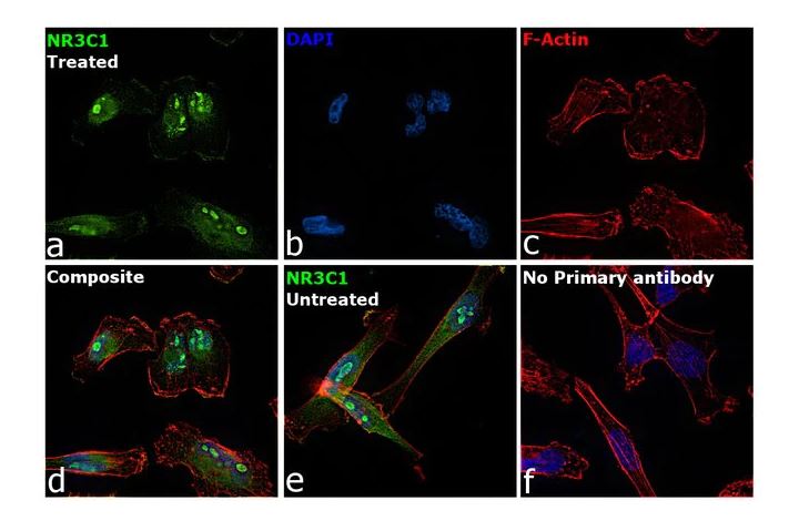 Immunocytochemistry/ Immunofluorescence - Anti-Glucocorticoid Receptor antibody (AB3579), expandable thumbnail