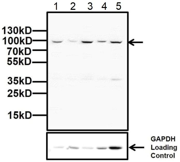 Western blot - Anti-Glucocorticoid Receptor antibody (AB3579)