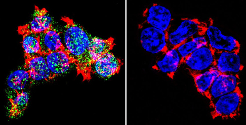 Immunocytochemistry/ Immunofluorescence - Anti-Glucocorticoid Receptor antibody (AB3671), expandable thumbnail