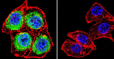 Immunocytochemistry/ Immunofluorescence - Anti-Glucocorticoid Receptor antibody (AB3671)