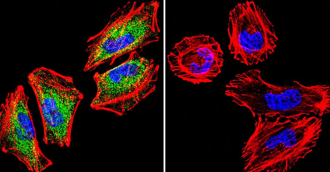 Immunocytochemistry/ Immunofluorescence - Anti-Glucocorticoid Receptor antibody (AB3671), expandable thumbnail