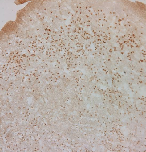 Immunohistochemistry (Formalin/PFA-fixed paraffin-embedded sections) - Anti-Glucocorticoid Receptor antibody (AB3671), expandable thumbnail