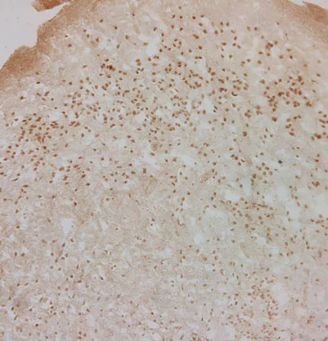 Immunohistochemistry (Formalin/PFA-fixed paraffin-embedded sections) - Anti-Glucocorticoid Receptor antibody (AB3671)