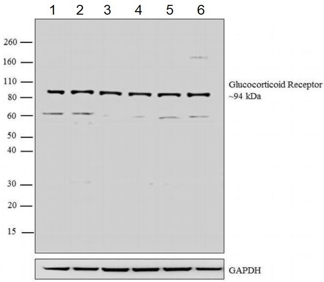 Western blot - Anti-Glucocorticoid Receptor antibody (AB3671), expandable thumbnail