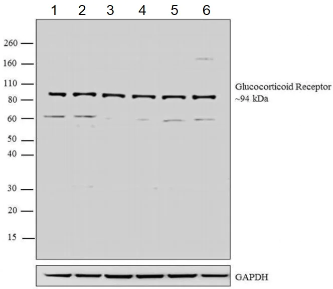 Western blot - Anti-Glucocorticoid Receptor antibody (AB3671)