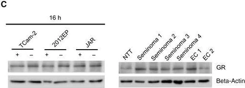 Western blot - Anti-Glucocorticoid Receptor antibody (AB3671)