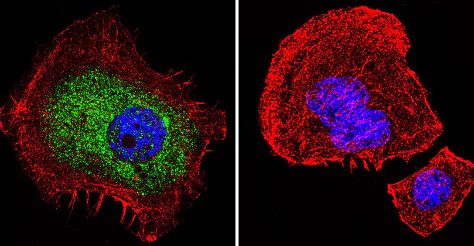 Immunocytochemistry/ Immunofluorescence - Anti-Glucocorticoid Receptor antibody [BuGR2] (AB2768)