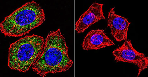 Immunocytochemistry/ Immunofluorescence - Anti-Glucocorticoid Receptor antibody [BuGR2] (AB2768)