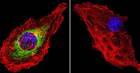 Immunocytochemistry/ Immunofluorescence - Anti-Glucocorticoid Receptor antibody [BuGR2] (AB2768)