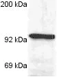 Western blot - Anti-Glucocorticoid Receptor antibody [BuGR2] (AB2768)