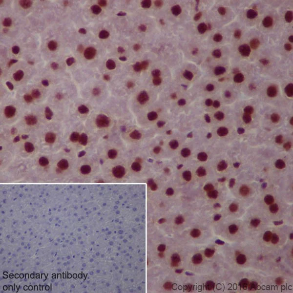 Immunohistochemistry (Formalin/PFA-fixed paraffin-embedded sections) - Anti-Glucocorticoid Receptor antibody [EPR19621] (AB183127)