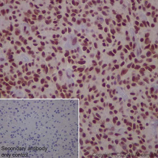 Immunohistochemistry (Formalin/PFA-fixed paraffin-embedded sections) - Anti-Glucocorticoid Receptor antibody [EPR19621] (AB183127)