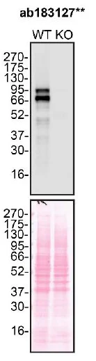Western blot - Anti-Glucocorticoid Receptor antibody [EPR19621] (AB183127)