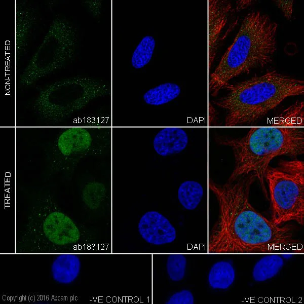 Immunocytochemistry/ Immunofluorescence - Anti-Glucocorticoid Receptor antibody [EPR19621] - BSA and Azide free (AB223138)