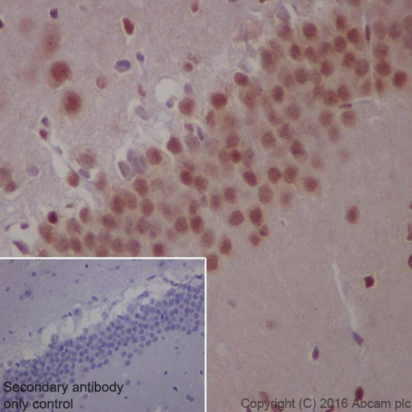 Immunohistochemistry (Formalin/PFA-fixed paraffin-embedded sections) - Anti-Glucocorticoid Receptor antibody [EPR19621] - BSA and Azide free (AB223138)