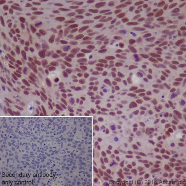 Immunohistochemistry (Formalin/PFA-fixed paraffin-embedded sections) - Anti-Glucocorticoid Receptor antibody [EPR19621] - BSA and Azide free (AB223138)