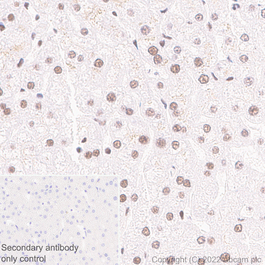 Immunohistochemistry (Formalin/PFA-fixed paraffin-embedded sections) - Anti-Glucocorticoid receptor antibody [EPR24889-231]- BSA and Azide free (ab305051), expandable thumbnail