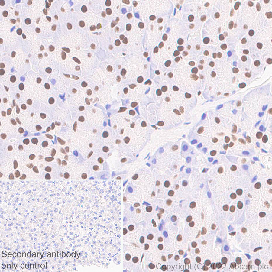 Immunohistochemistry (Formalin/PFA-fixed paraffin-embedded sections) - Anti-Glucocorticoid receptor antibody [EPR24889-231]- BSA and Azide free (ab305051), expandable thumbnail